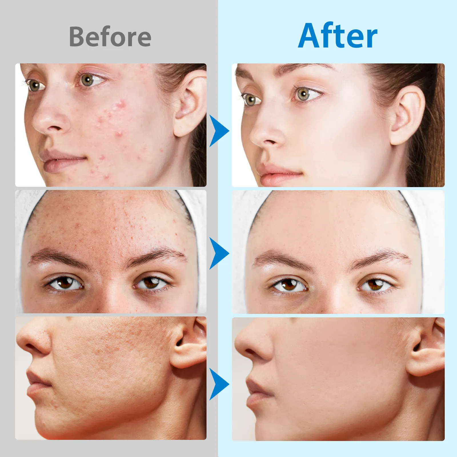 Aliver GLYCOLIC ACID PADSWITH VITAMINS B3,B5 & C, E 40p